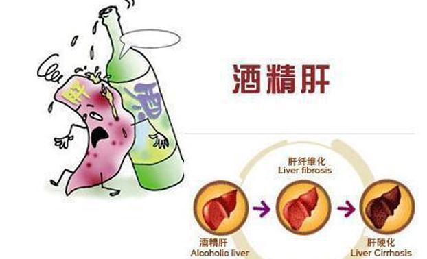 节制酒精摄入对肝脏损伤的预防与保护作用