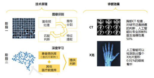深度学习提升医疗图像识别精确度